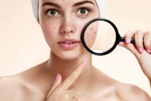 Say Goodbye to Acne: Discover the Power of Chemical-Free Bakuchiol Face Serum!